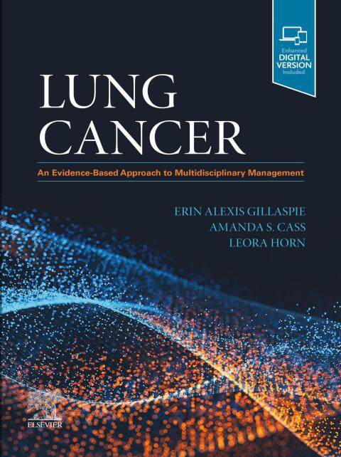 Cover image for book Lung Cancer: An Evidence-Based Approach to Multidisciplinary Management