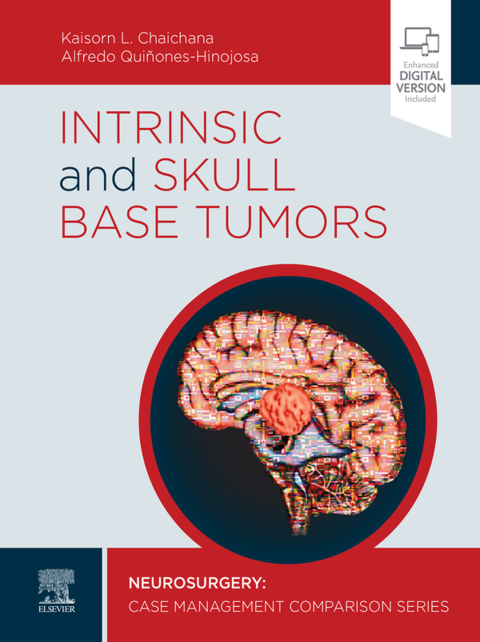 Cover image for book Intrinsic and Skull Base Tumors