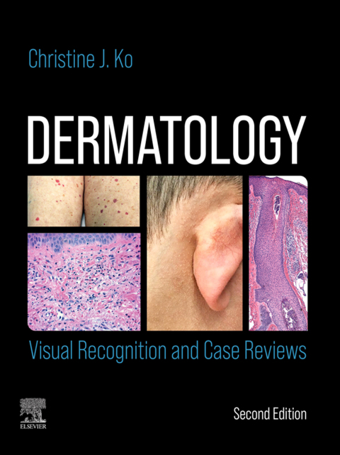 Cover image for book Dermatology: Visual Recognition and Case Reviews