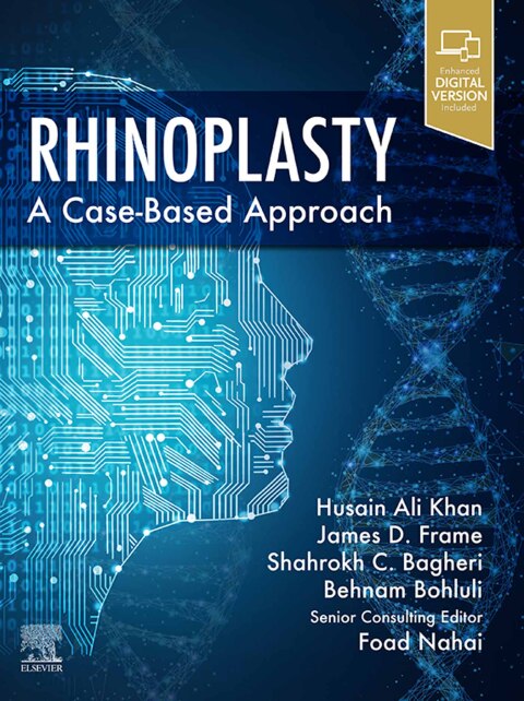 Cover image for book Rhinoplasty