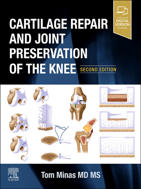 Cover image for book Cartilage Repair and Joint Preservation of the Knee