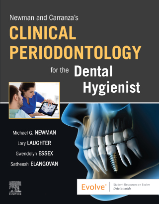Newman and Carranza’s Clinical Periodontology for the Dental Hygienist