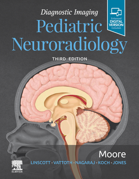 Cover image for book Diagnostic Imaging: Pediatric Neuroradiology E-Book