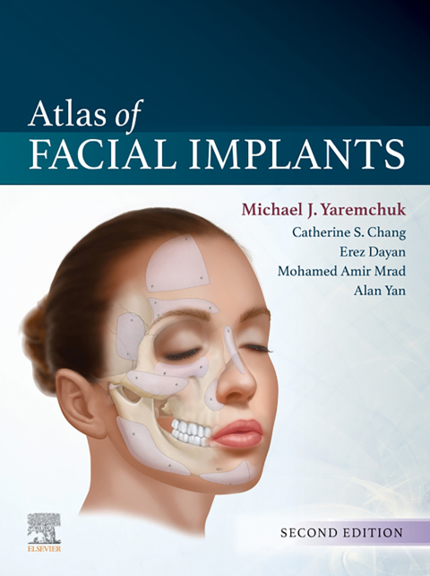 Cover image for book Atlas of Facial Implants