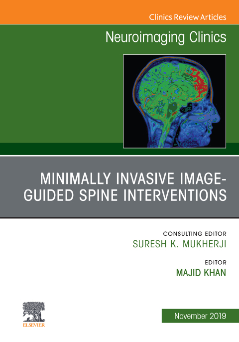 Cover image for book Spine Intervention, An Issue of Neuroimaging Clinics of North America