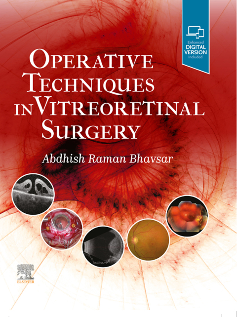 Cover image for book Operative Techniques in Vitreoretinal Surgery