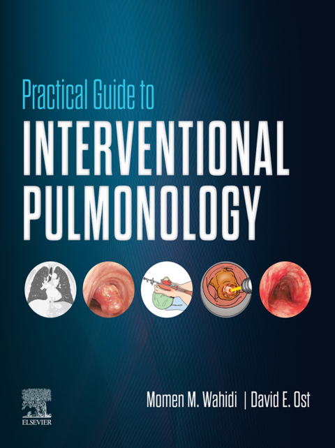 Cover image for book Practical Guide to Interventional Pulmonology