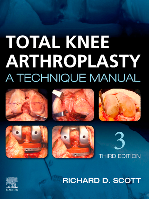 Cover image for book Total Knee Arthroplasty