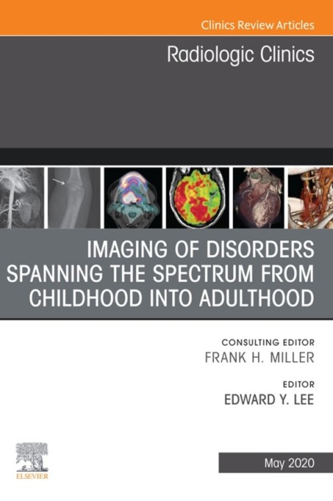 Imaging of Disorders Spanning the Spectrum from Childhood ,An Issue of Radiologic Clinics of North America 