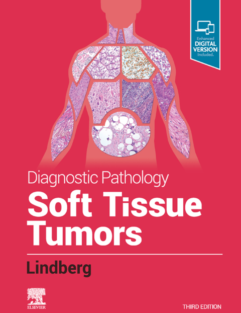 Cover image for book Diagnostic Pathology: Soft Tissue Tumors