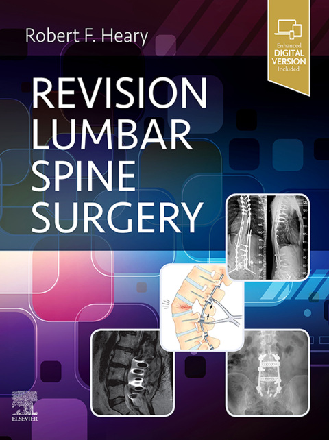 Cover image for book Revision Lumbar Spine Surgery