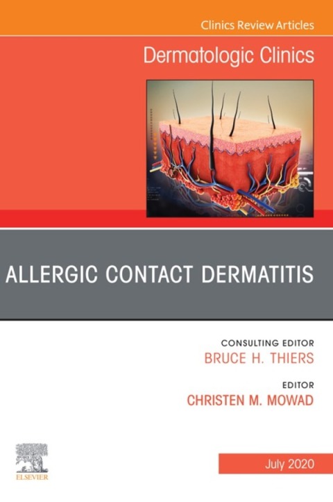 Cover image for book Allergic Contact Dermatitis,An Issue of Dermatologic Clinics