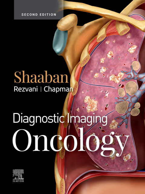 Cover image for book Diagnostic Imaging: Oncology E-Book