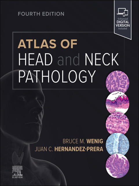 Cover image for book Atlas of Head and Neck Pathology