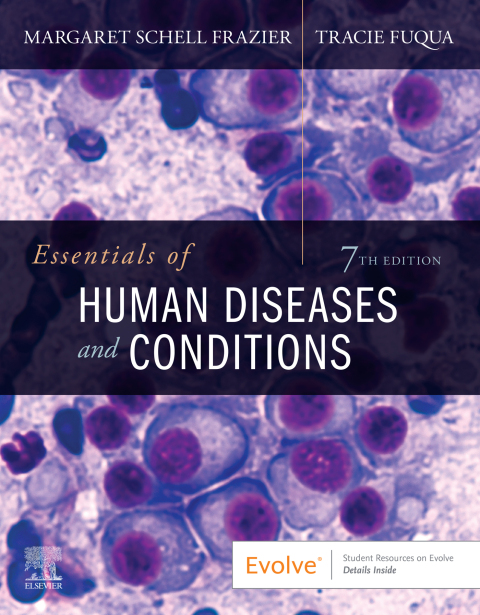 Cover image for book Essentials of Human Diseases and Conditions