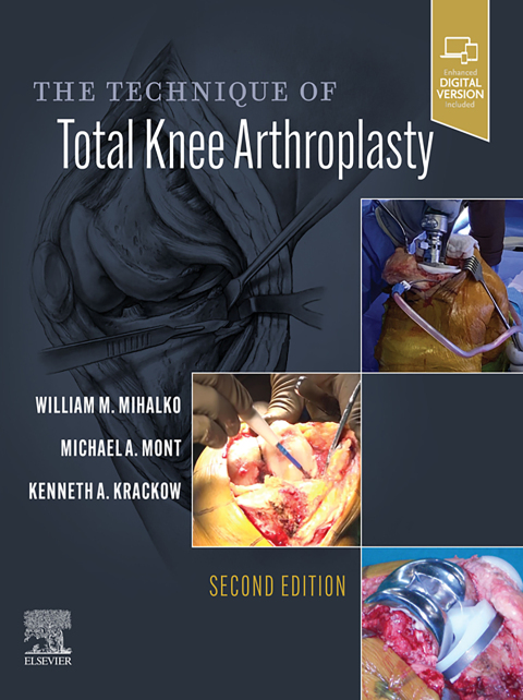 Cover image for book The Technique of Total Knee Arthroplasty