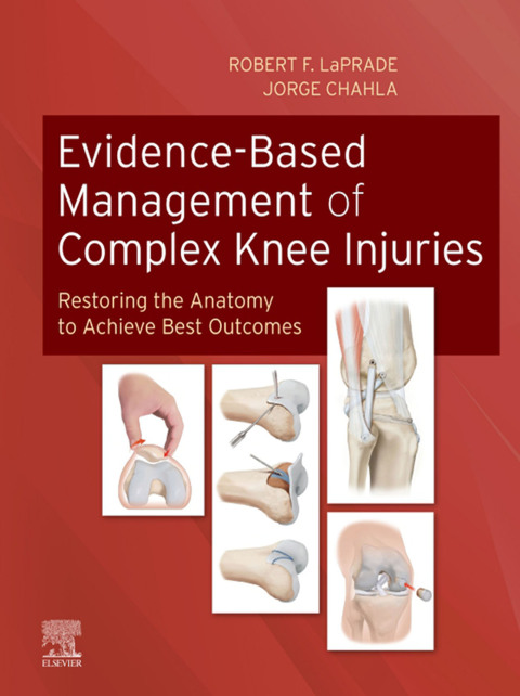 Cover image for book Evidence-Based Management of Complex Knee Injuries