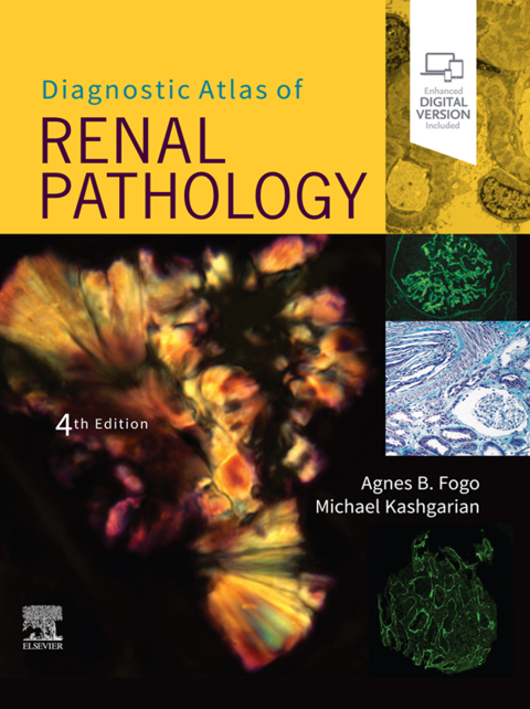 Diagnostic Atlas of Renal Pathology 