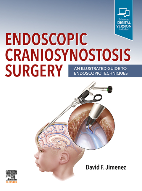 Cover image for book Endoscopic Craniosynostosis Surgery