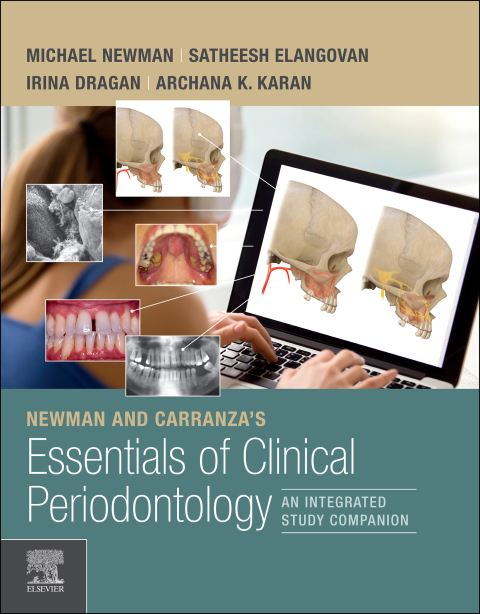 Cover image for book Newman and Carranza's Essentials of Clinical Periodontology