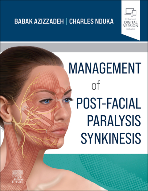 Cover image for book Management of Post-Facial Paralysis Synkinesis