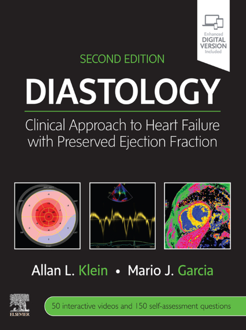 Cover image for book Diastology E-Book