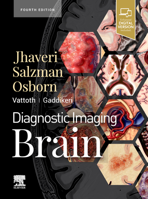 Cover image for book Diagnostic Imaging: Brain