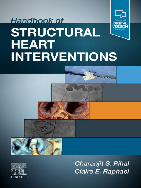 Cover image for book Handbook of Structural Heart Interventions