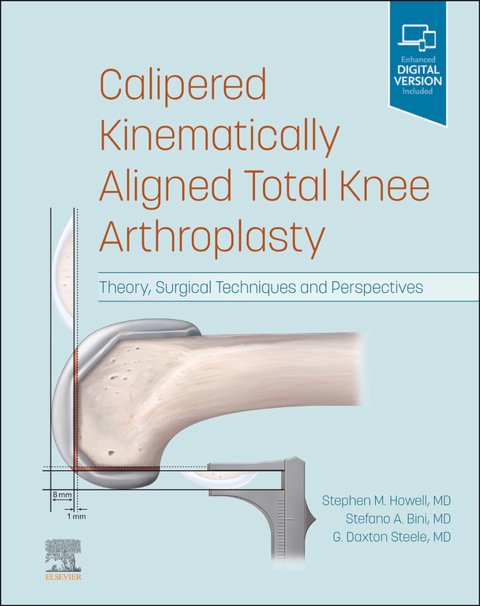 Cover image for book Calipered Kinematically aligned Total Knee Arthroplasty