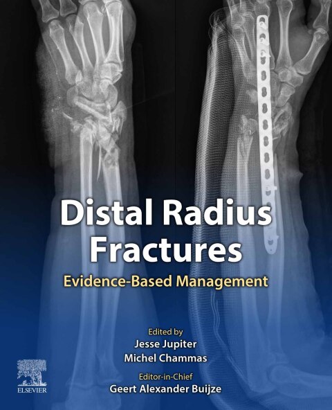 Cover image for book Distal Radius Fractures