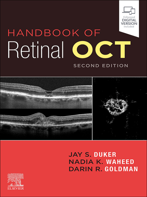 Cover image for book Handbook of Retinal OCT: Optical Coherence Tomography