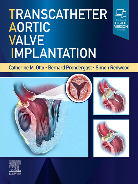 Cover image for book Transcatheter Aortic Valve Implantation