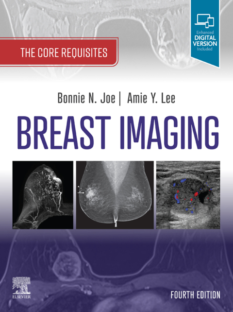 Breast Imaging, E-Book 