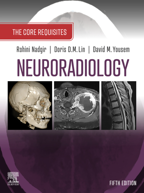 Cover image for book Neuroradiology: The Core Requisites