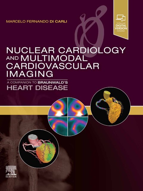 Cover image for book Nuclear Cardiology and Multimodal Cardiovascular Imaging