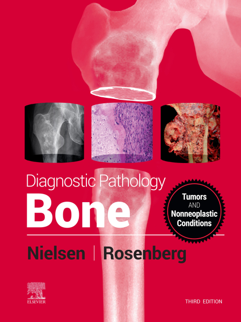 Cover image for book Diagnostic Pathology: Bone