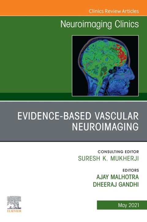 Cover image for book Evidence-Based Vascular Neuroimaging, An Issue of Neuroimaging Clinics of North America