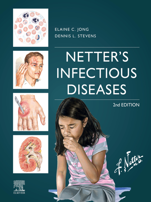 Cover image for book Netter's Infectious Diseases
