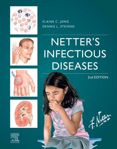 Cover image for book Netter's Infectious Diseases