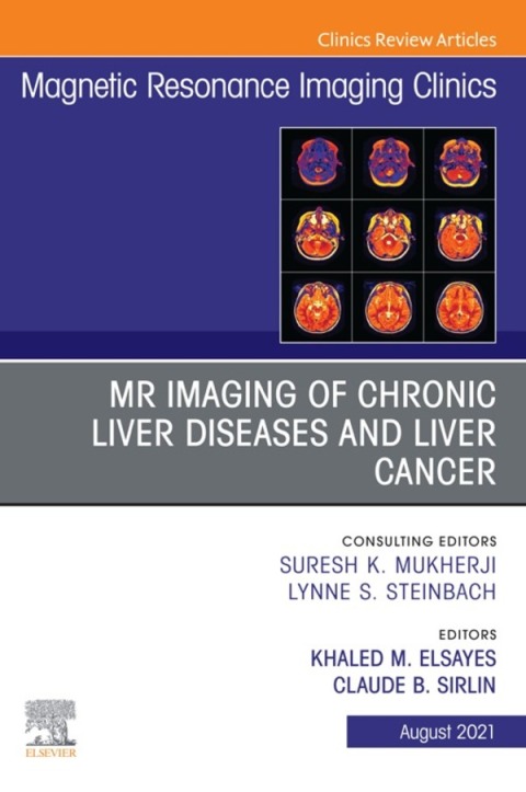 Cover image for book MR Imaging of Chronic Liver Diseases and Liver Cancer, An Issue of Magnetic Resonance Imaging Clinics of North America