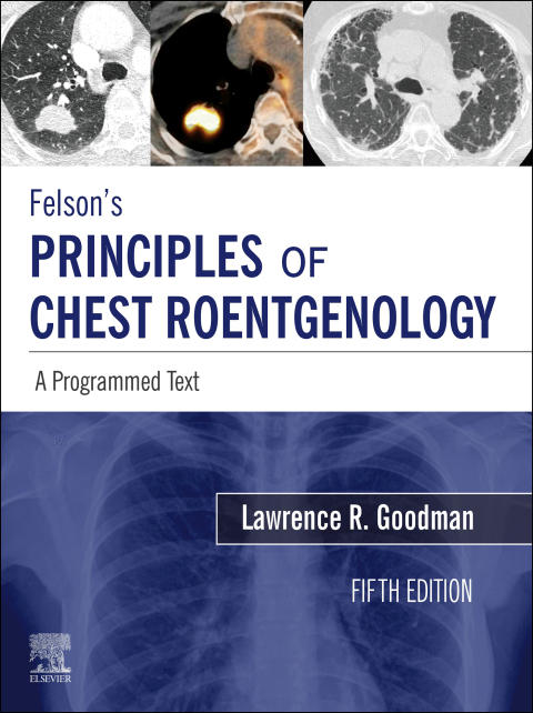 Cover image for book Felson's Principles of Chest Roentgenology