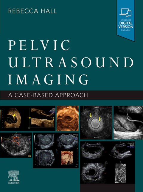 Cover image for book Pelvic Ultrasound Imaging