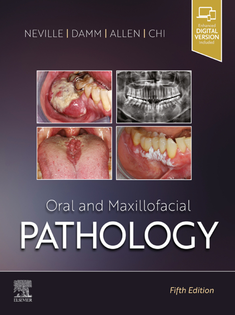 Cover image for book Oral and Maxillofacial Pathology