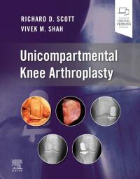 Cover image: Unicompartmental Knee Arthroplasty 9780323790109