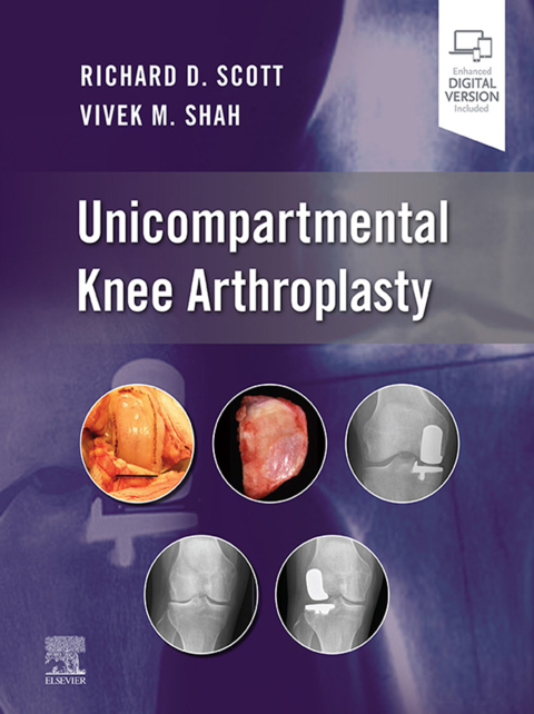 Cover image for book Unicompartmental Knee Arthroplasty