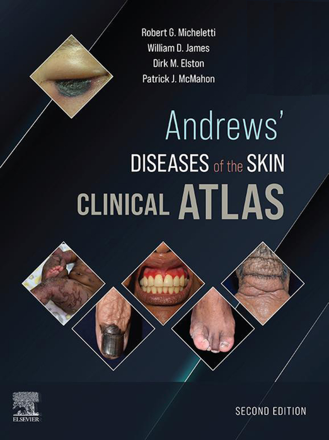 Andrews' Diseases of the Skin Clinical Atlas