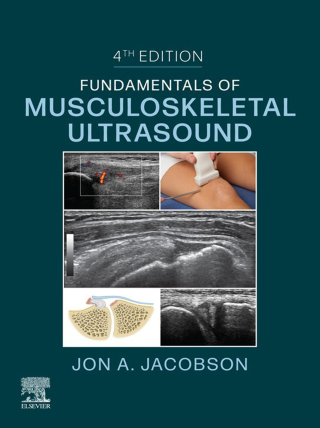 Fundamentals of Musculoskeletal Ultrasound