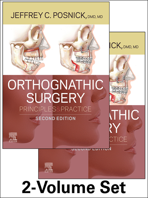 Cover image for book Orthognathic Surgery - 2 Volume Set
