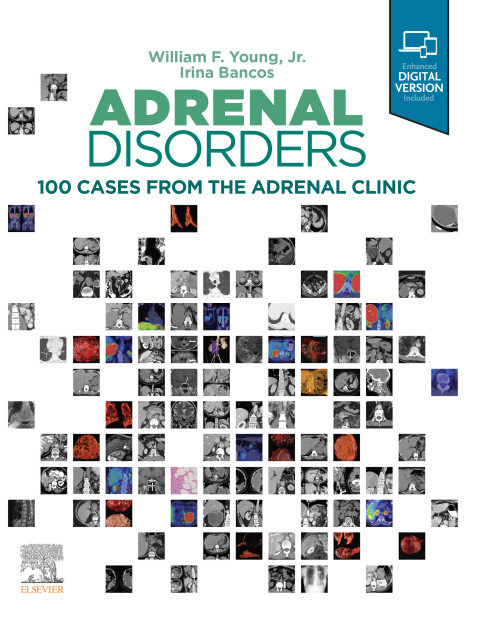 Adrenal Disorders,E-Book 