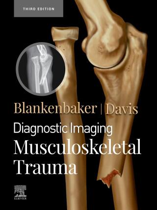 Diagnostic Imaging: Musculoskeletal Trauma